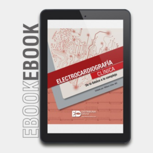 Ebook Electrocardiorafía Clínica. De lo Básico a lo Complejo