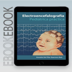 Ebook Electroencefalogria pediatrica practica