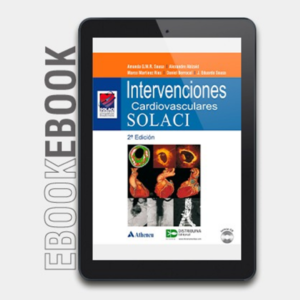 Ebook Intervenciones cardiovasculares. SOLACI