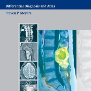 MRI of Bone and Soft Tissue Tumors and Tumorlike Lesions Differential Diagnosis and Atlas