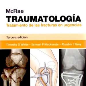 Mcrae. Traumatología. Tratamiento de las fracturas en urgencias3ra edición