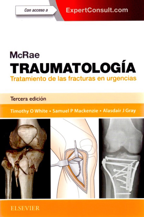 Mcrae. Traumatología. Tratamiento de las fracturas en urgencias3ra edición