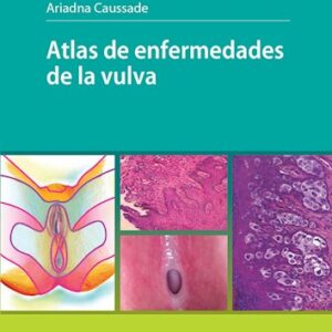 Atlas de enfermedades de la vulva  / Autores: Caussade, Ariadna