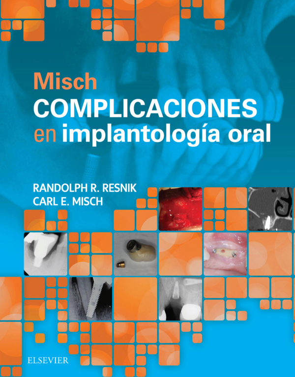 Misch. Complicaciones en implantología oral 1ra edición /Resnik. Randolph