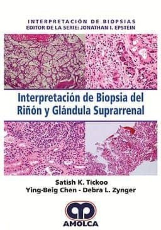 Interpretación de Biopsia del Riñón y Glándula Suprarrenal - Satish K. Tickoo