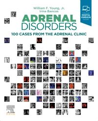 Adrenal Disorders, 1st Edition 100 Cases from the Adrenal Clinic  - Authors :  William F. Young & Irina Bancos