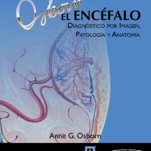 El Encéfalo Diagnóstico por imagen, patología y anatomía  - Anne G. Osborn