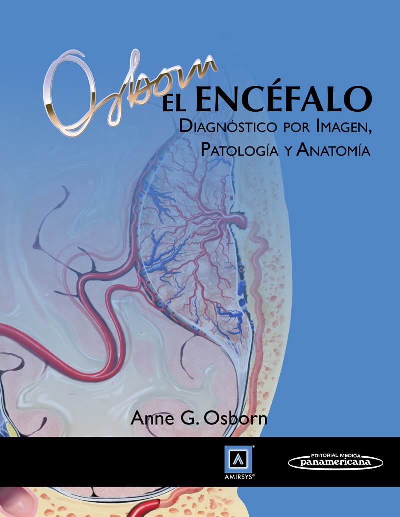 El Encéfalo Diagnóstico por imagen, patología y anatomía - Anne G. Osborn