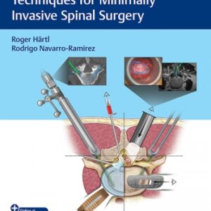 Essential Step-by-Step Techniques for Minimally Invasive Spinal Surgery Hartl - Navarro-Ramirez