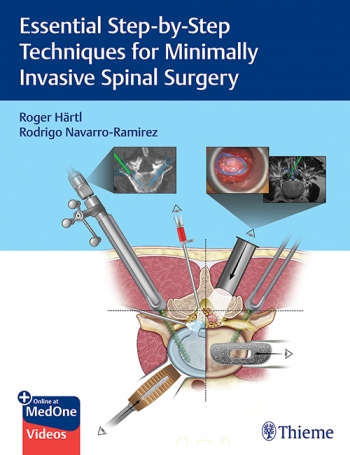 Essential Step-by-Step Techniques for Minimally Invasive Spinal Surgery Hartl - Navarro-Ramirez