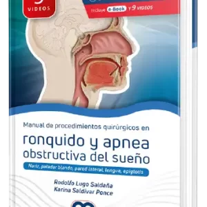 Manual de Procedimiento quirúrgicos en Ronquido y Apnea obstructiva del sueño - Rodolfo Lugo Saldaña
