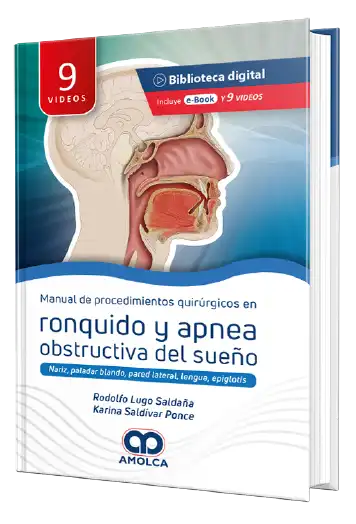 Manual de Procedimiento quirúrgicos en Ronquido y Apnea obstructiva del sueño - Rodolfo Lugo Saldaña