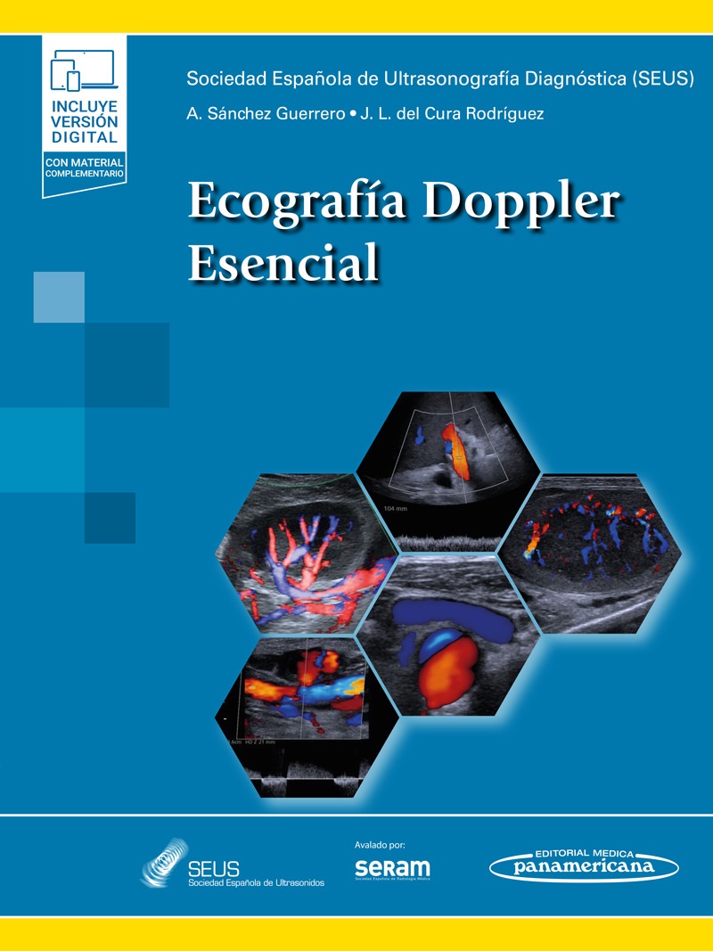 Ecografía Doppler Esencial - SEUS Sociedad Española de Ultrasonidos,