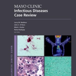 Mayo Clinic Infectious Disease Case Review With Board-Style Questions and Answers - Larry M. Baddour, John C. O'Horo, Mark J. Enzler