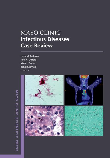 Mayo Clinic Infectious Disease Case Review With Board-Style Questions and Answers - Larry M. Baddour, John C. O'Horo, Mark J. Enzler