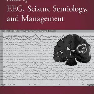 Atlas of EEG, Seizure Semiology, and Management 3 edition - Bassel Abou-Khalil, Karl Edward Misulis, Hasan Sonmezturk, and Kevin C. Ess