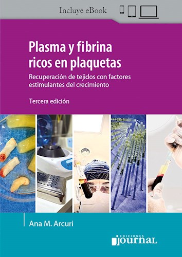 Plasma y fibrina ricos en plaquetas Ed.3 Recuperación de tejidos con factores estimulantes del crecimiento - Autores: Arcuri, Ana M.