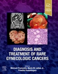 Diagnosis and Treatment of Rare Gynecologic Cancers, 1st Edition  - Authors : Michael Frumovitz & Mario Leitao & Preetha Ramalingam