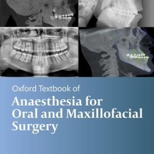 Oxford Textbook of Anaesthesia for Oral and Maxillofacial Surgery, Second Edition - Edited by Patrick A. Ward and Michael G. Irwin -