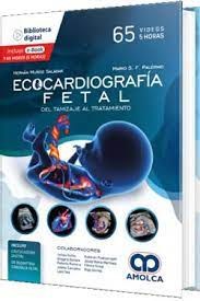 Ecocardiografía Fetal. Del Tamizaje al tratamiento   - MUÑOZ - PALERMO