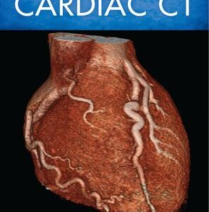The Complete Guide To Cardiac CT (PB) - By Simeon Abramson - 1st Edition