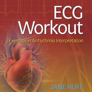 ECG Workout Exercises in Arrhythmia Interpretation   -  Author(s): LOREDA J. HUFF
