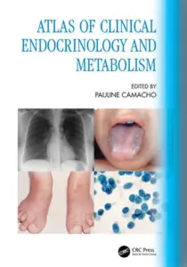 Atlas of Clinical Endocrinology and Metabolism Edited By Pauline Camacho