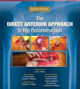 The Direct Anterior Approach to Hip Reconstruction Edition: 2 - Author(s): Lee E. Rubin , B. Sonny Bal , Joseph T. Moskal