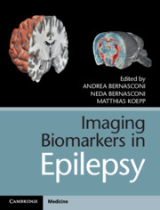 Imaging Biomarkers in Epilepsy - EDITORS:Andrea Bernasconi, Montreal Neurological Institute, McGill UniversityNeda Bernasconi, Montreal Neurological Institute, McGill UniversityMatthias Koepp, Institute of Neurology, University College London