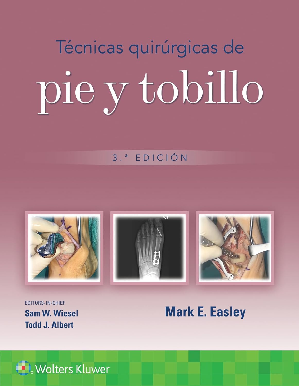 Técnicas quirúrgicas de pie y tobillo Edition: 3 - Author(s): Mark Erik Easley MD