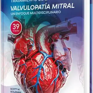 Diagnóstico y tratamiento de la valvulopatía mitral