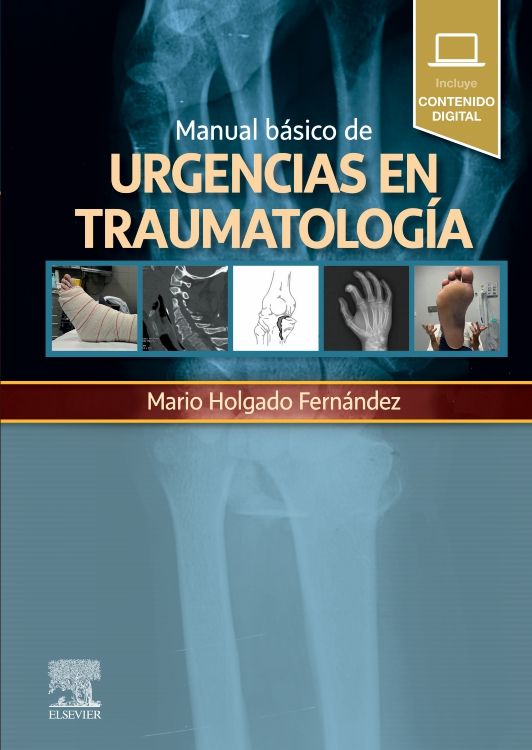 Manual básico de urgencias en traumatología - Editor : Mario Holgado
