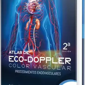 Atlas de Eco-doppler color vascular. Procedimientos endovasculares1