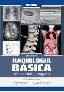 Radiología Básica :  Rx  - Tc  -Rm  -Ecografía  - EDITOR: ULLOA, L