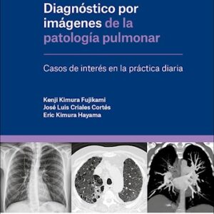 Diagnóstico por imágenes de la patología pulmonar 1 Edición - Autores: José Luis Criales Cortés, Kenji Kimura Fujikami,Eric Takehiro Kimura Hayama (copia)