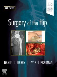 Surgery of the Hip, 2nd Edition Authors : Daniel J. Berry & Jay Lieberman