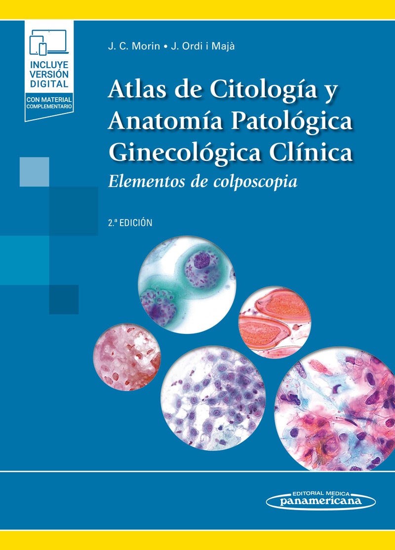 Atlas de Citología y Anatomía Patológica Ginecológica Clínica Elementos de colposcopia - Juan Carlos Morin Gamarra,Jaume Ordi i Majá