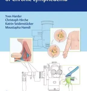 Modern Surgical Management of Chronic Lymphedema - Yves Harder, Christoph Hirche, Katrin Seidenstücker, Moustapha Hamdi