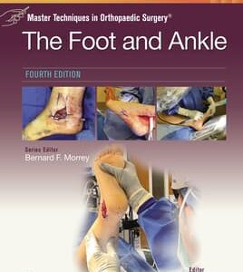 Master Techniques in Orthopaedic Surgery: The Foot and Ankle: Print + eBook with Multimedia Edition: 4 -  Author(s): Scott Ellis MD