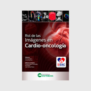 Rol de las imágenes en cardio-oncología - Autor: Pamela Rojo, Silvia Makhoul