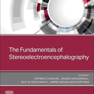 The Fundamentals of Stereoelectroencephalography, 1st Edition Editors : Patrick Chauvel & Jorge Gonzalez-Martinez & Aileen McGonigal & Guy M. McKhann II