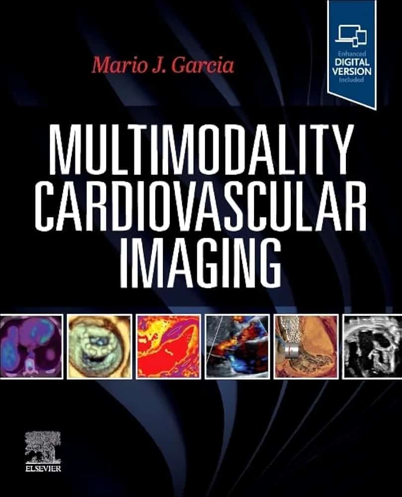Multimodality Cardiovascular Imaging, 1st Edition Editor : Mario J. Garcia