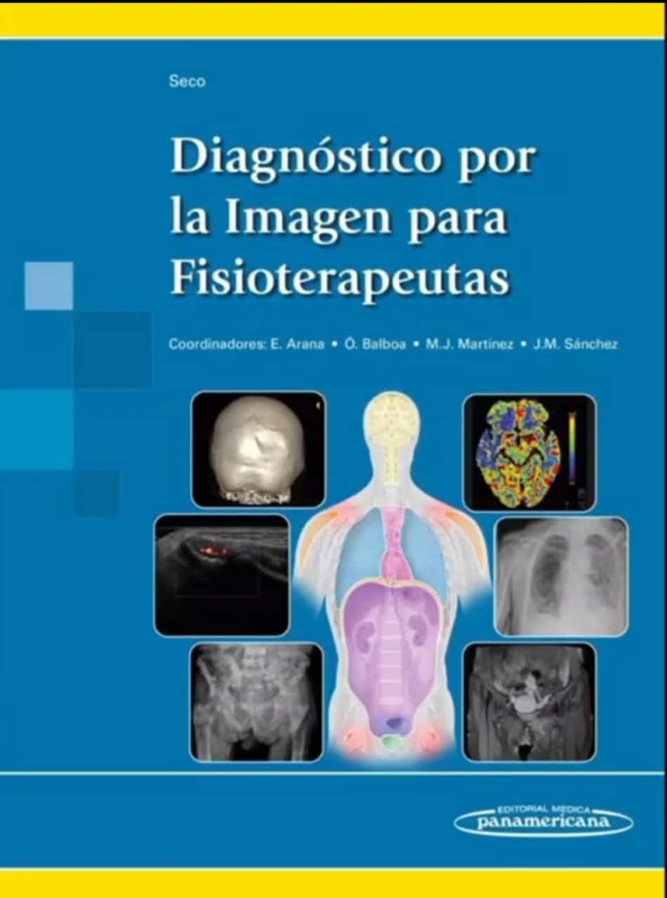 Diagnóstico por la Imagen para Fisioterapeutas /Novedad /Jesús Seco Calvo,Estanislao Arana Fernández De Moya,Óscar Balboa Arregui,Mª Jesús Martinez Mier,Jorge Mario Sánchez Reyes