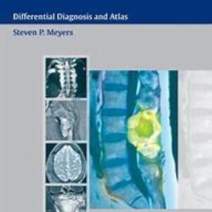 MRI of Bone and Soft Tissue Tumors and Tumorlike Lesions: Differential Diagnosis and Atlas / S.P. Meyers. Stuttgart,
