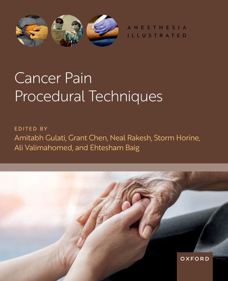 Cancer Pain Procedural Techniques Edited by Amitabh Gulati, Neal Rakesh, Grant Chen, Storm Horine, Ali Valimahomed, and Ehtesham Baig