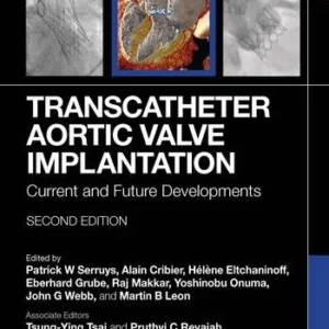 Transcatheter Aortic Valve Implantation Current and Future Developments - Edited By Patrick W. Serruys, Alain Cribier, Helene Eltchaninoff, Eberhard Grube, Raj Makkar, Yoshinobu Onuma, John G. Webb, Martin B. Leon