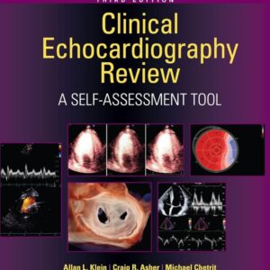 Clinical Echocardiography Review A Self-Assessment Tool: Print + eBook with Multimedia Edition: Author(s): Allan L. Klein MD, FRCP(C), FACC, FAHA, , Craig R. Asher MD
