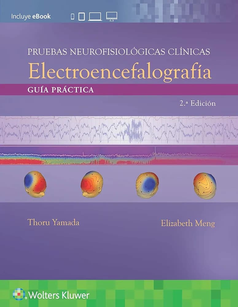 Pruebas neurofisiológicas clínicas. Electroencefalografía Guía práctica Edition: 2 - Author(s): Thoru Yamada MD, Elizabeth Meng BA, R.EEG/EP T