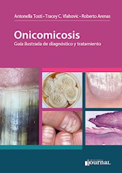 Onicomicosis Guía ilustrada de diagnóstico y tratamiento 1 Edición Autores: Antonella Tosti Roberto Arenas Tracey Vlahovic