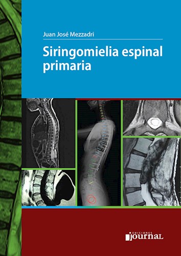 Siringomielia espinal primaria 1 Edición Autores: Juan José Mezzadri